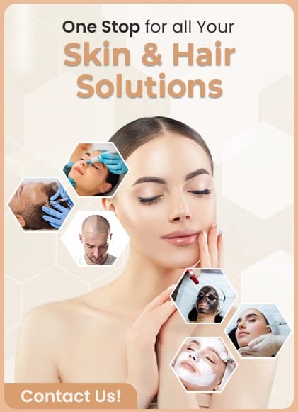 Laser Beard Shaping Treatment