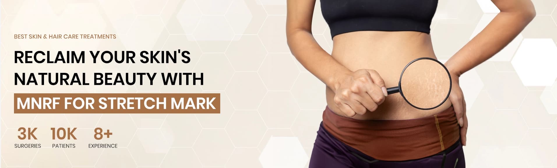 mnrf for stretch mark desktop