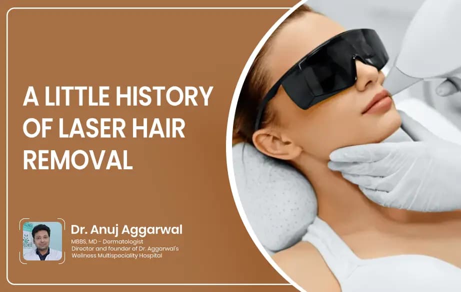 A Little History of Laser Hair Removal