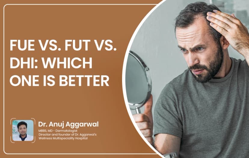 FUE vs. FUT vs. DHI: Which One Is Better?