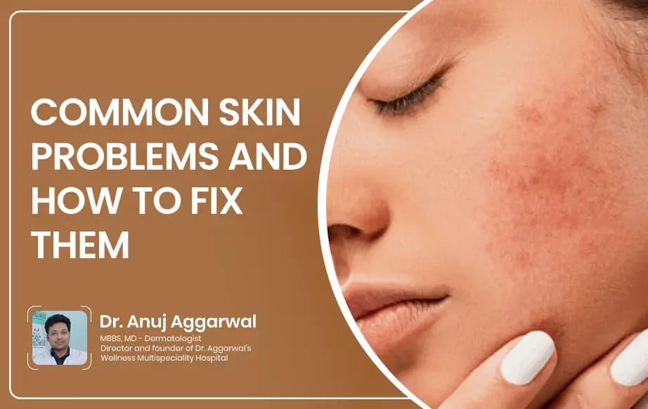 Common Skin Problems