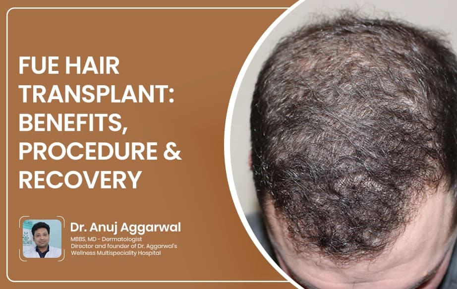 FUE Hair Transplant: Benefits, Procedure & Recovery