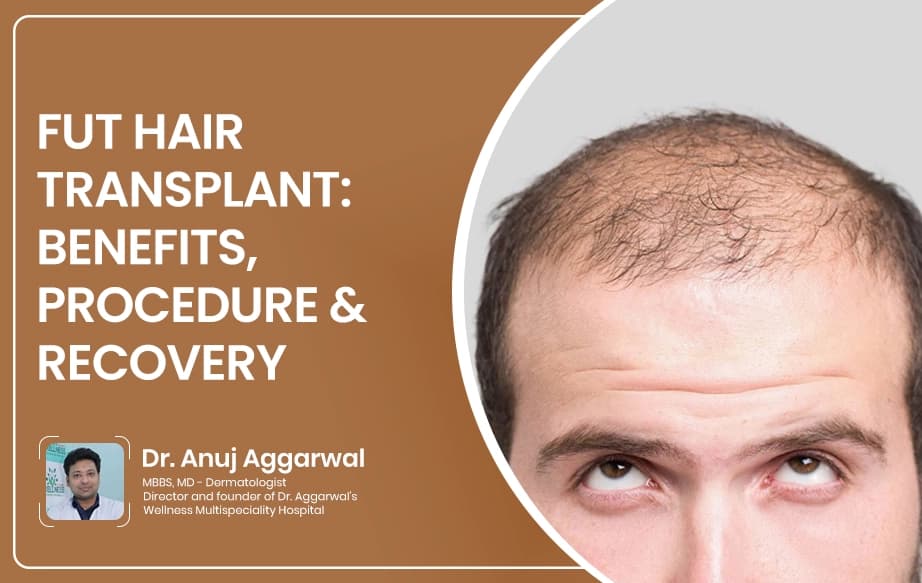 FUT Hair Transplant: Benefits, Procedure & Recovery
