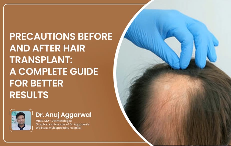 Precautions Before and After Hair Transplant