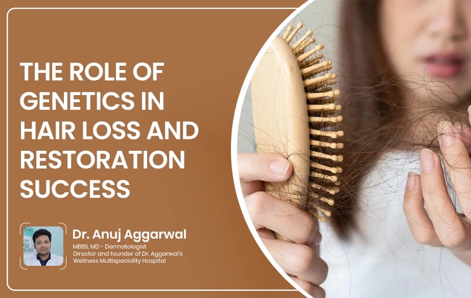The Role of Genetics in Hair Loss and Restoration Success