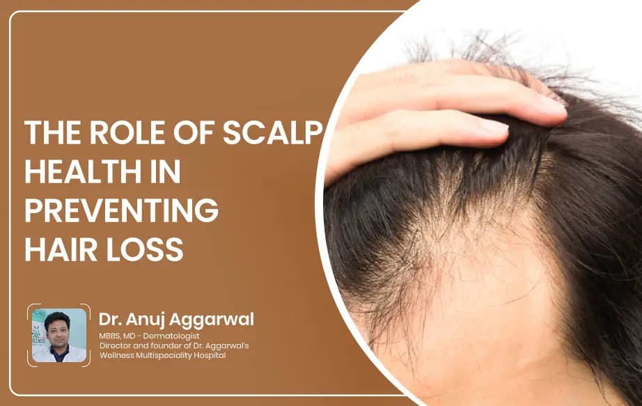 The Role of Scalp Health in Preventing Hair Loss