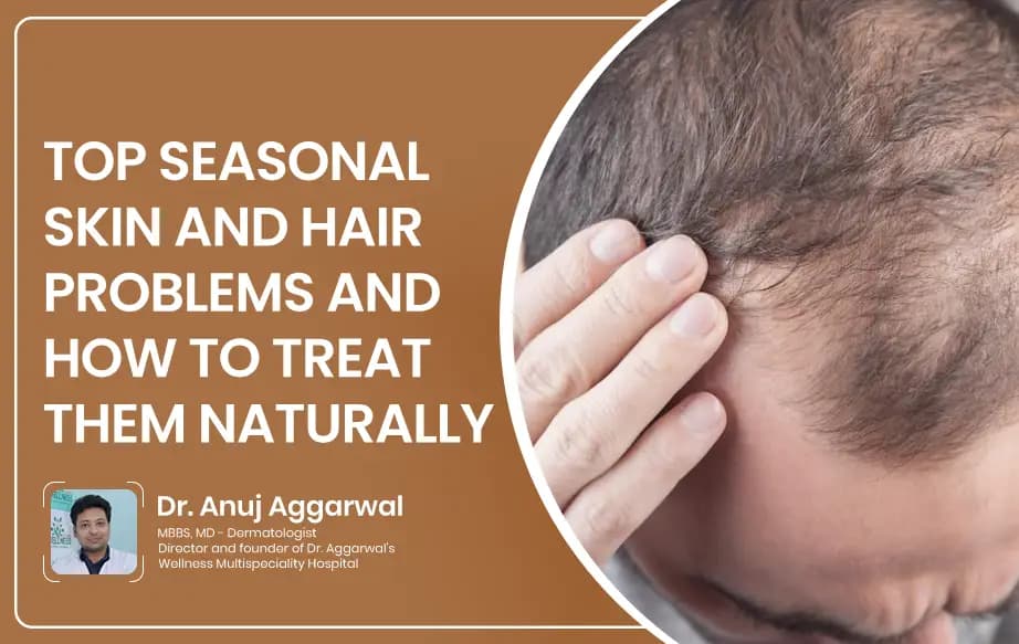 Top Seasonal Skin and Hair Problems