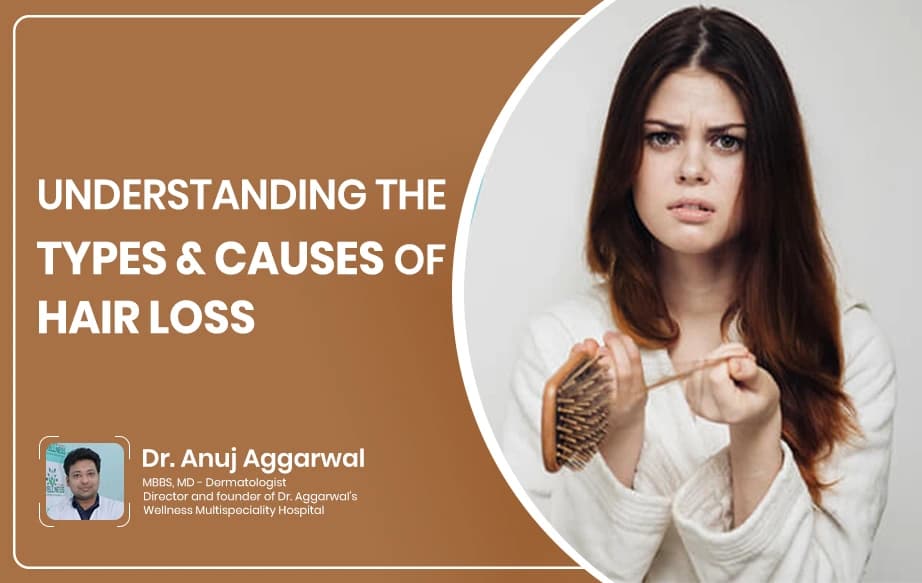 Types and Causes of Hair Loss