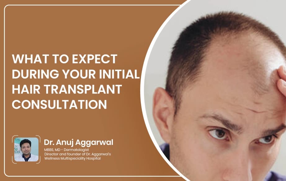 What to Expect During Your Initial Hair Transplant Consultation
